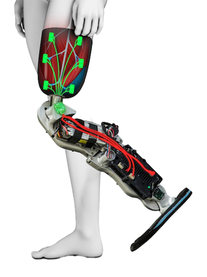 Bionic Prosthetic Lower Limbs
