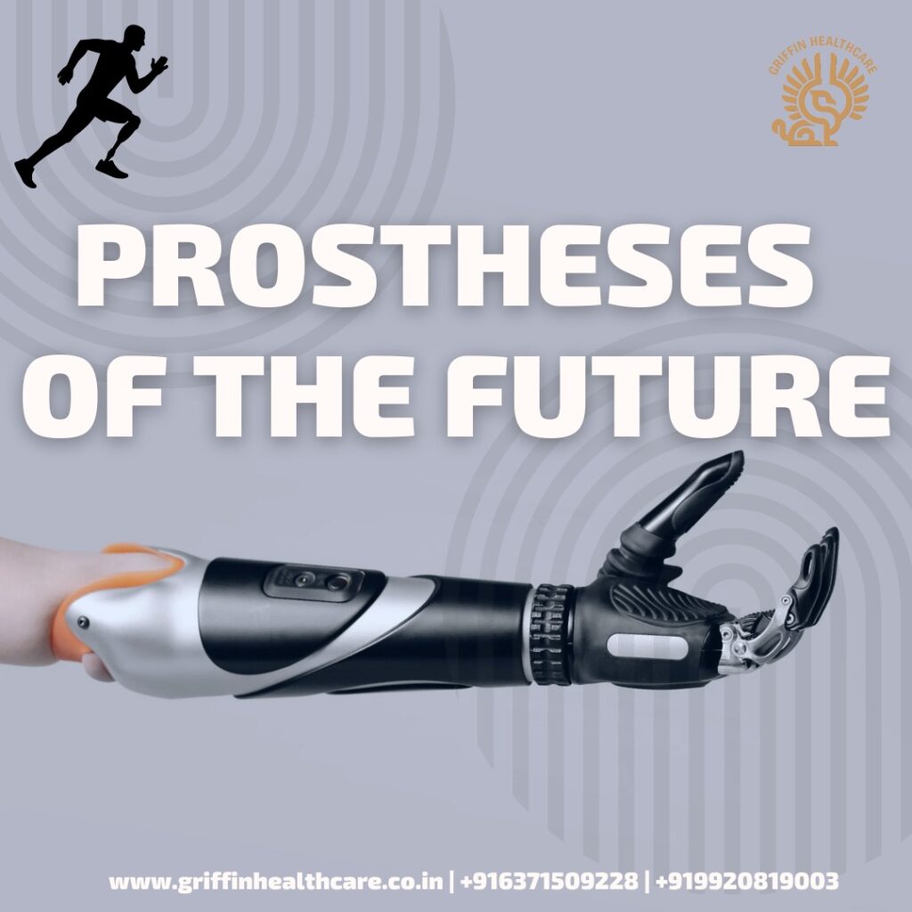 prosthetics