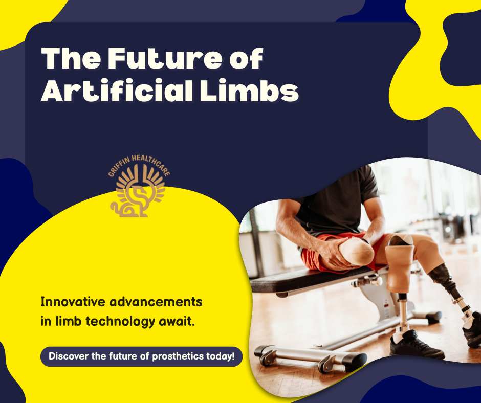 artificial-limb